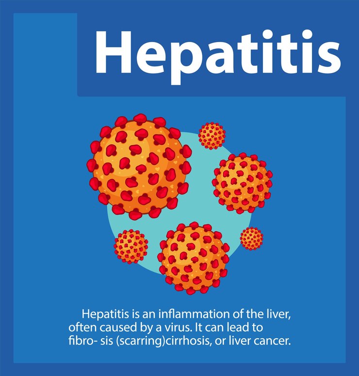 A graphic illustration of the liver with surrounding labels describing Hepatitis. The liver is shown in a healthy state and also in a state affected by Hepatitis, highlighting inflammation and damage. 
