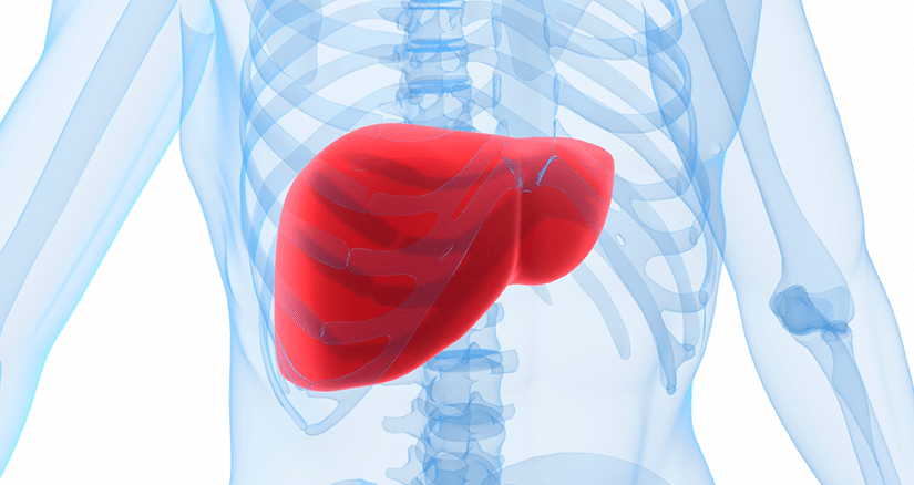 Medical illustration of hepatitis showing inflammation in the liver.