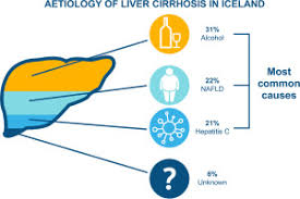 Medical illustration of hepatitis showing inflammation in the liver.