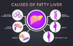 NAFLD