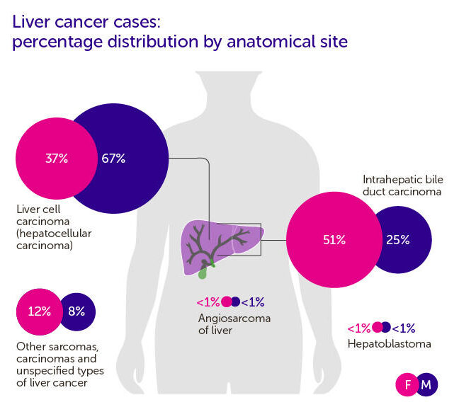 Hepatocellular Carcinoma Mortality