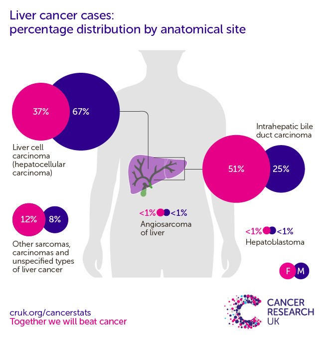 Hepatocellular Carcinoma Mortality